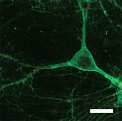 Mouse neuron expressing Arch gene